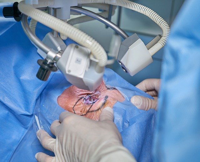 Cirurgia refrativa